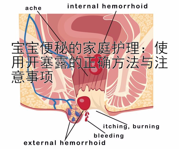 宝宝便秘的家庭护理：使用开塞露的正确方法与注意事项