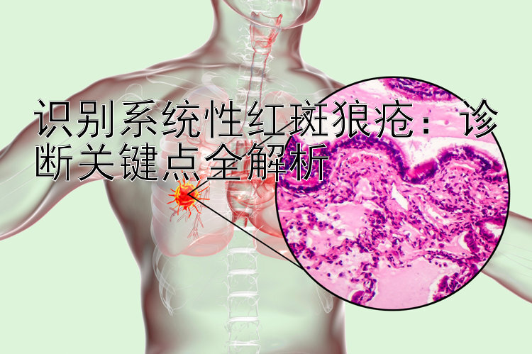 识别系统性红斑狼疮：诊断关键点全解析