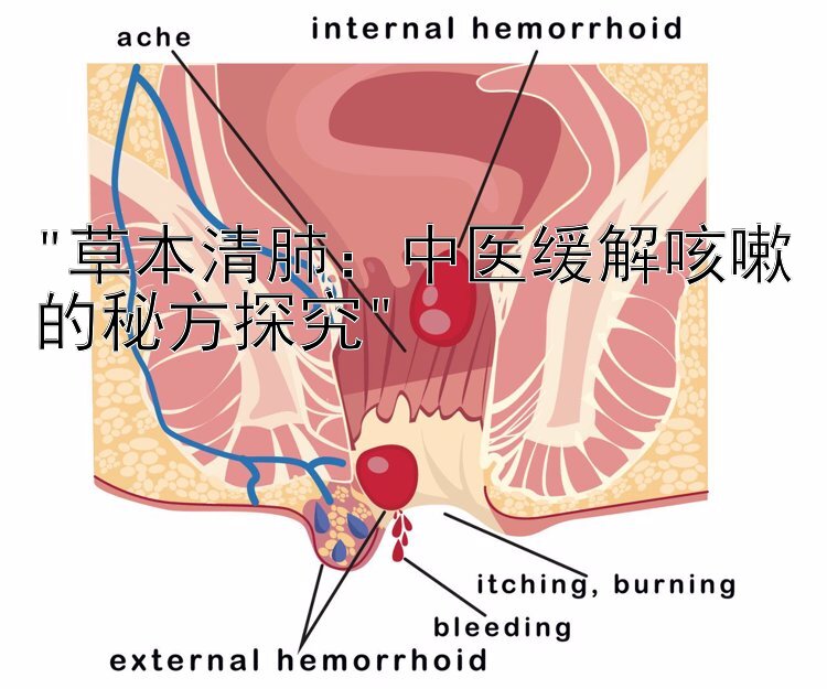 草本清肺：中医缓解咳嗽的秘方探究