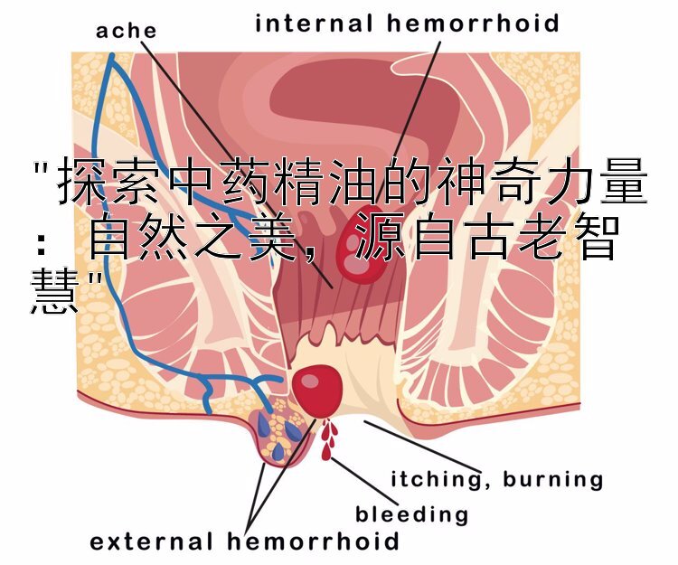 探索中药精油的神奇力量：自然之美，源自古老智慧