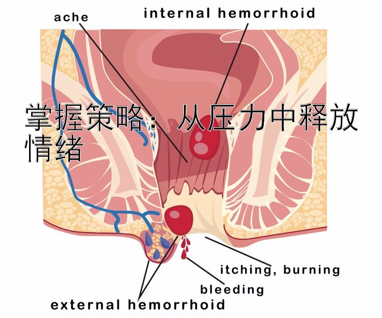 掌握策略：从压力中释放情绪