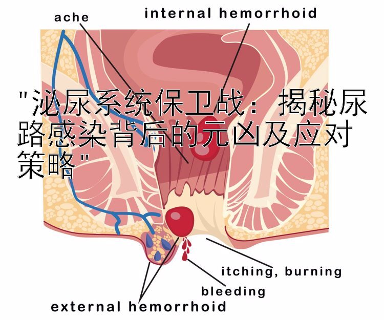 泌尿系统保卫战：揭秘尿路感染背后的元凶及应对策略