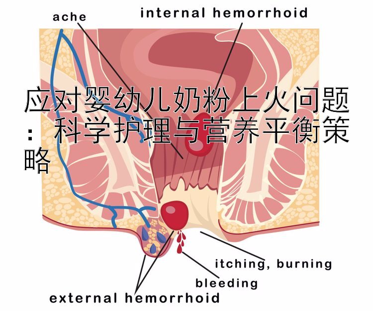 应对婴幼儿奶粉上火问题：科学护理与营养平衡策略