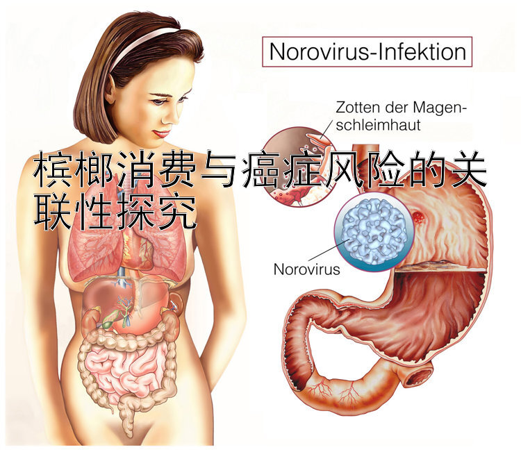 槟榔消费与癌症风险的关联性探究