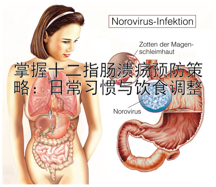 掌握十二指肠溃疡预防策略：日常习惯与饮食调整