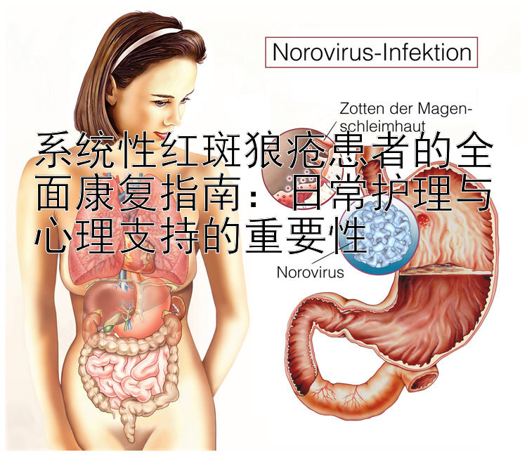 系统性红斑狼疮患者的全面康复指南：日常护理与心理支持的重要性