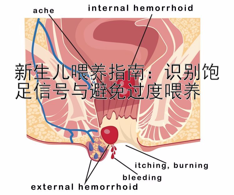 新生儿喂养指南：识别饱足信号与避免过度喂养