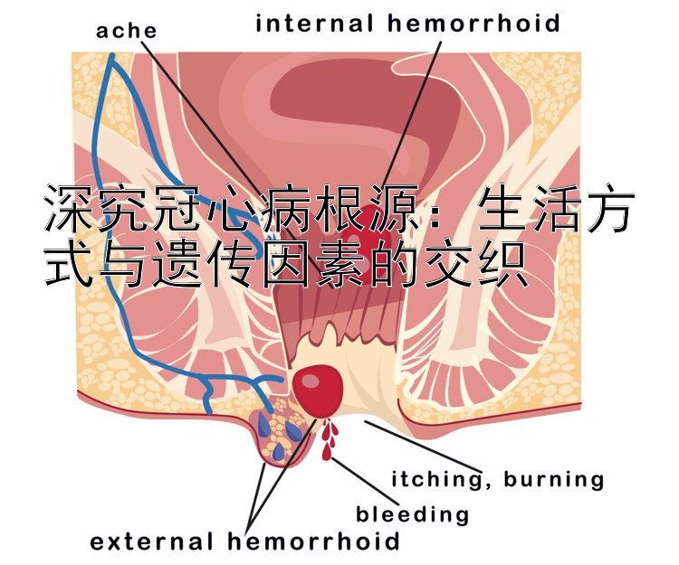 深究冠心病根源：生活方式与遗传因素的交织