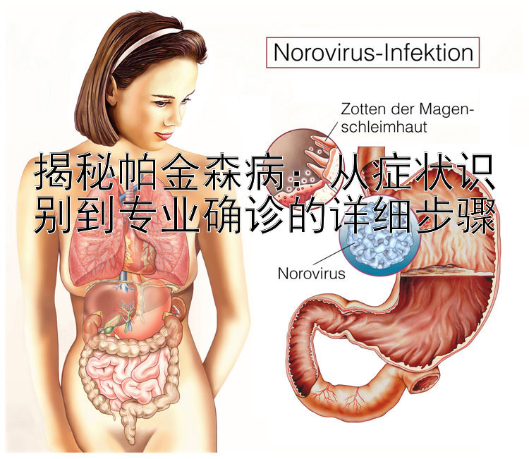 揭秘帕金森病：从症状识别到专业确诊的详细步骤