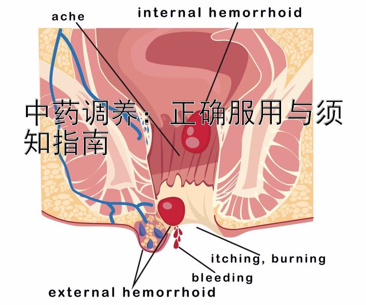 中药调养：正确服用与须知指南