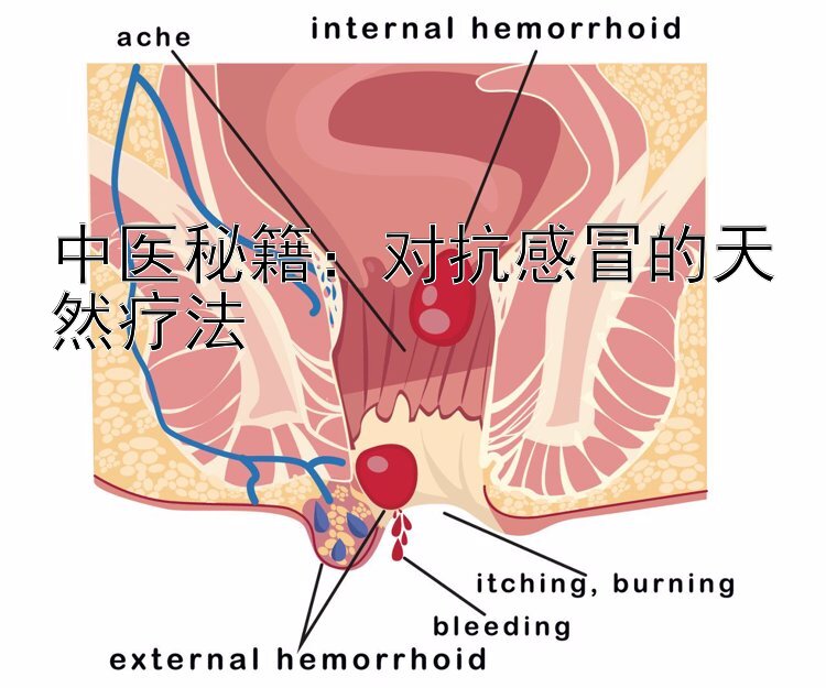 中医秘籍：对抗感冒的天然疗法