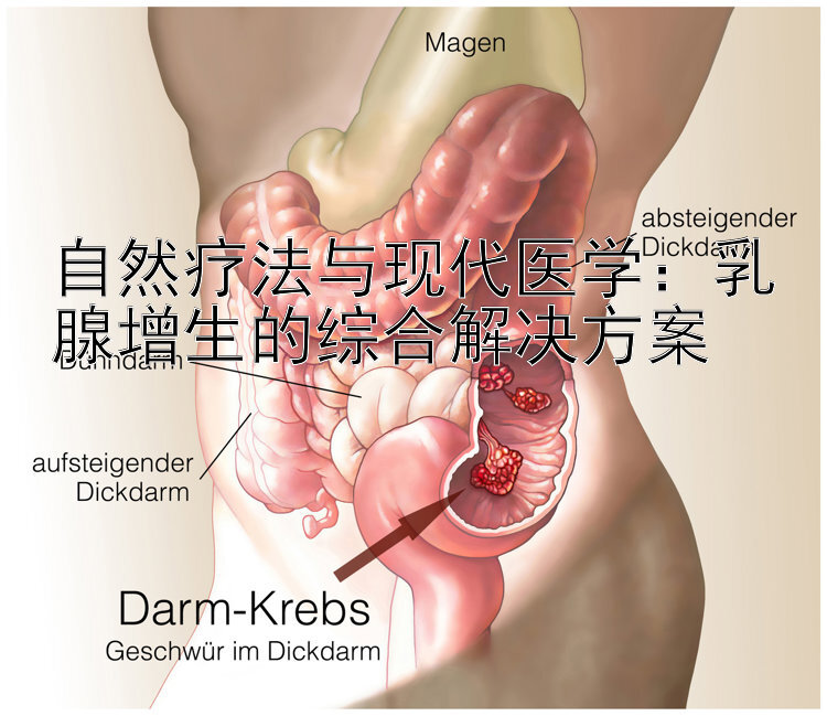 自然疗法与现代医学：乳腺增生的综合解决方案