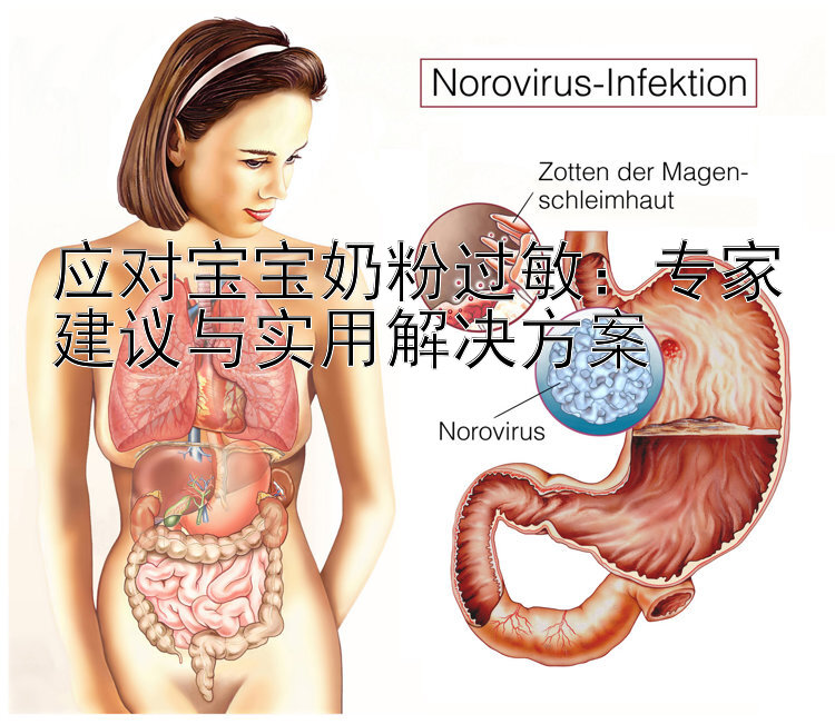 应对宝宝奶粉过敏：专家建议与实用解决方案