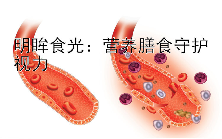 明眸食光：营养膳食守护视力