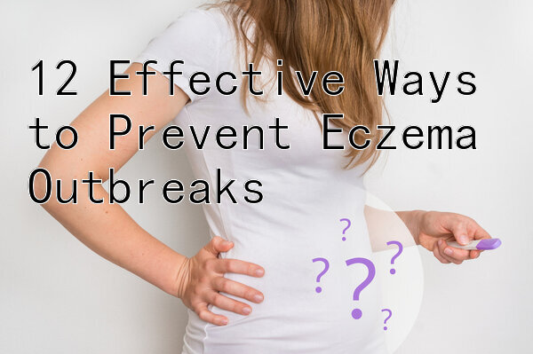 12 Effective Ways to Prevent Eczema Outbreaks