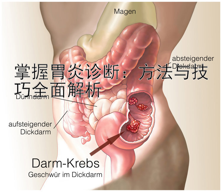 掌握胃炎诊断：方法与技巧全面解析