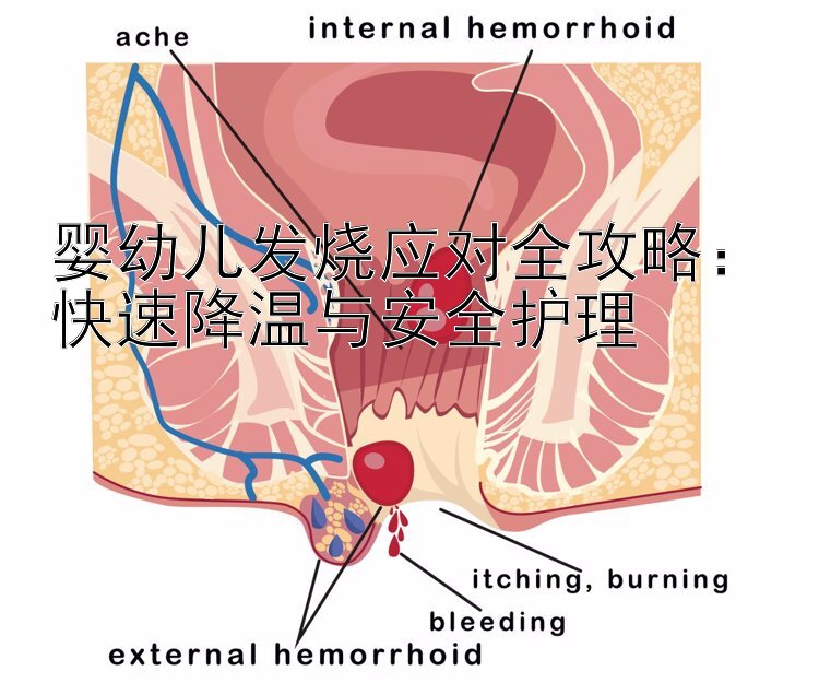 婴幼儿发烧应对全攻略：快速降温与安全护理