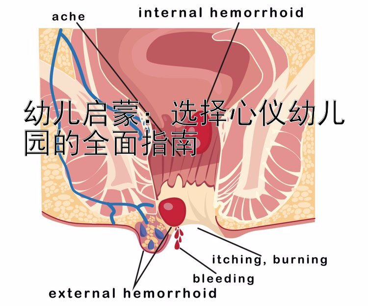 幼儿启蒙：选择心仪幼儿园的全面指南