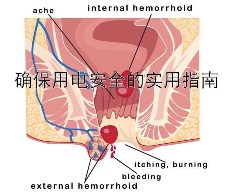 确保用电安全的实用指南