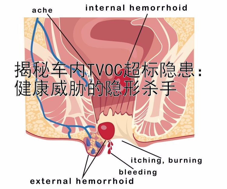 揭秘车内TVOC超标隐患：健康威胁的隐形杀手