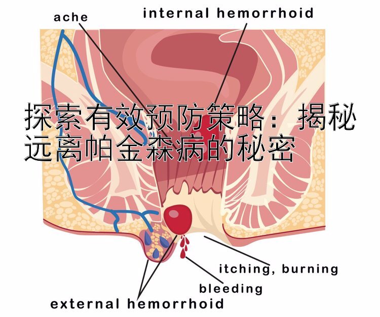 探索有效预防策略：揭秘远离帕金森病的秘密