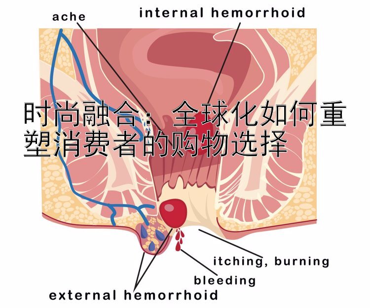 时尚融合：全球化如何重塑消费者的购物选择