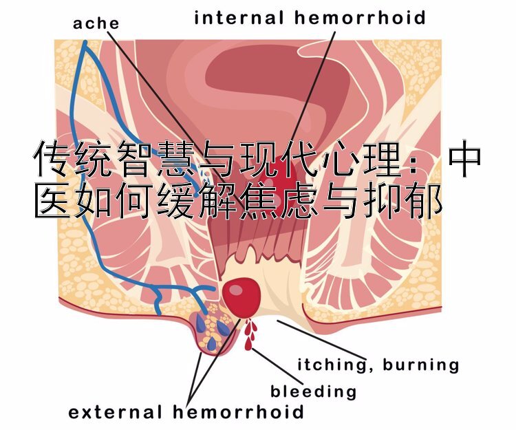 传统智慧与现代心理：中医如何缓解焦虑与抑郁