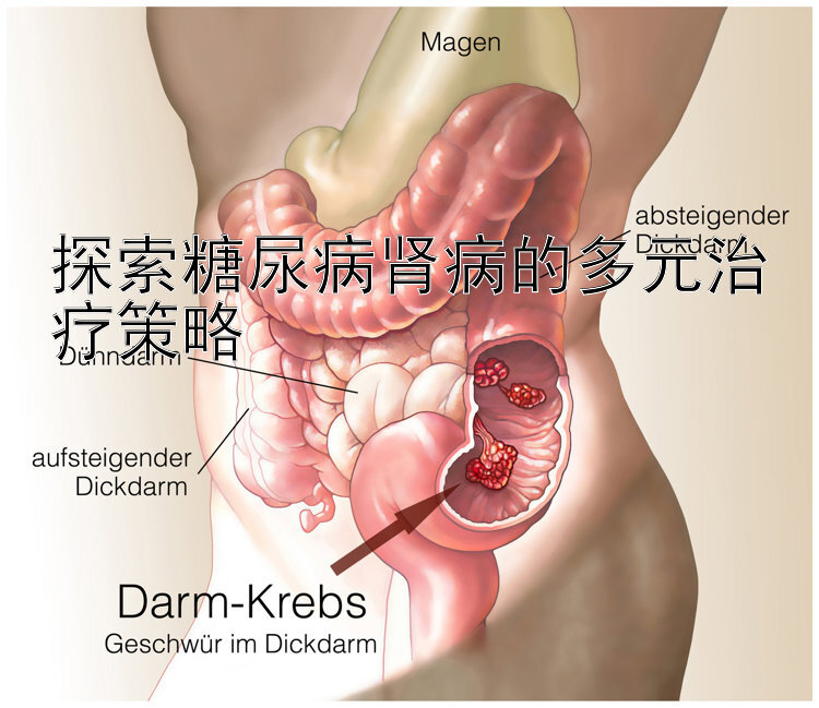 探索糖尿病肾病的多元治疗策略