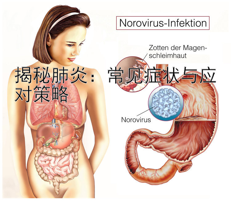 揭秘肺炎：常见症状与应对策略