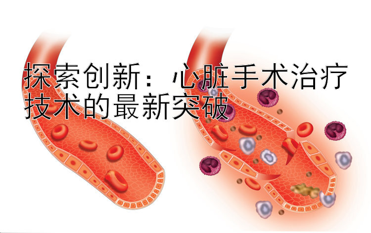 探索创新：心脏手术治疗技术的最新突破