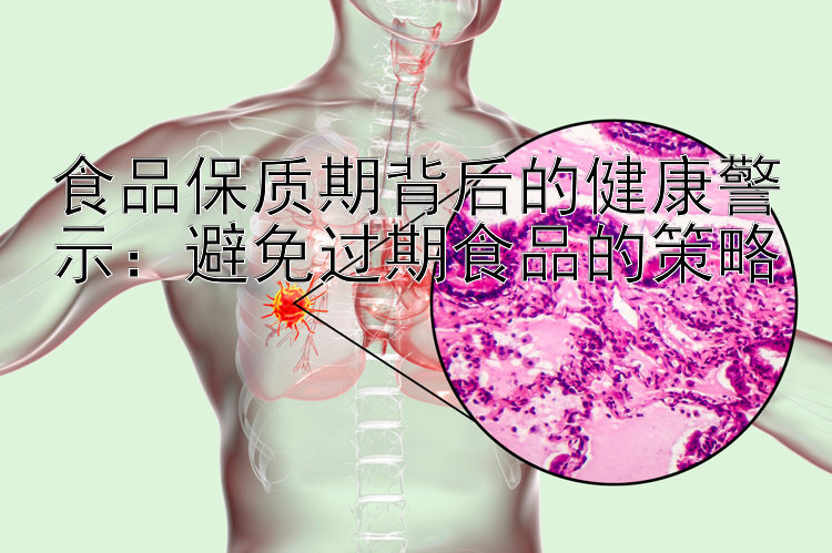 食品保质期背后的健康警示：避免过期食品的策略