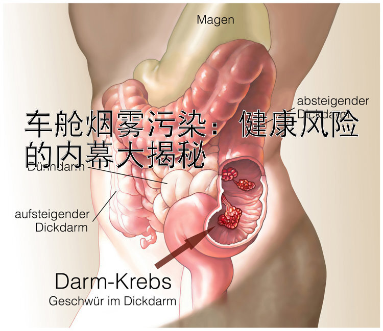 车舱烟雾污染：健康风险的内幕大揭秘