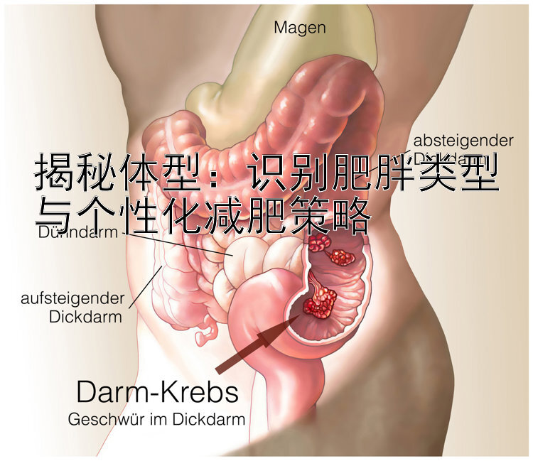 揭秘体型：识别肥胖类型与个性化减肥策略