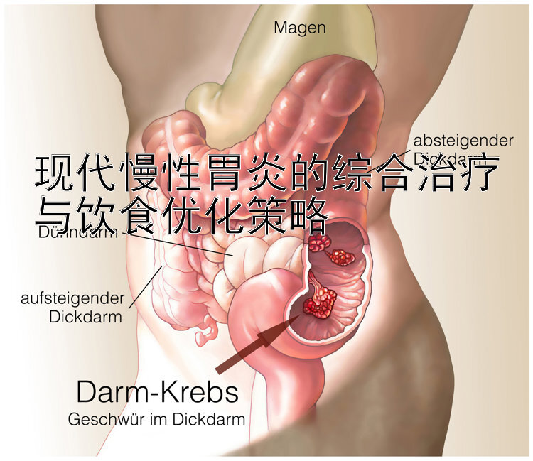 现代慢性胃炎的综合治疗与饮食优化策略