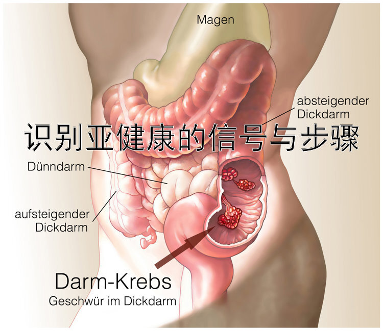 识别亚健康的信号与步骤