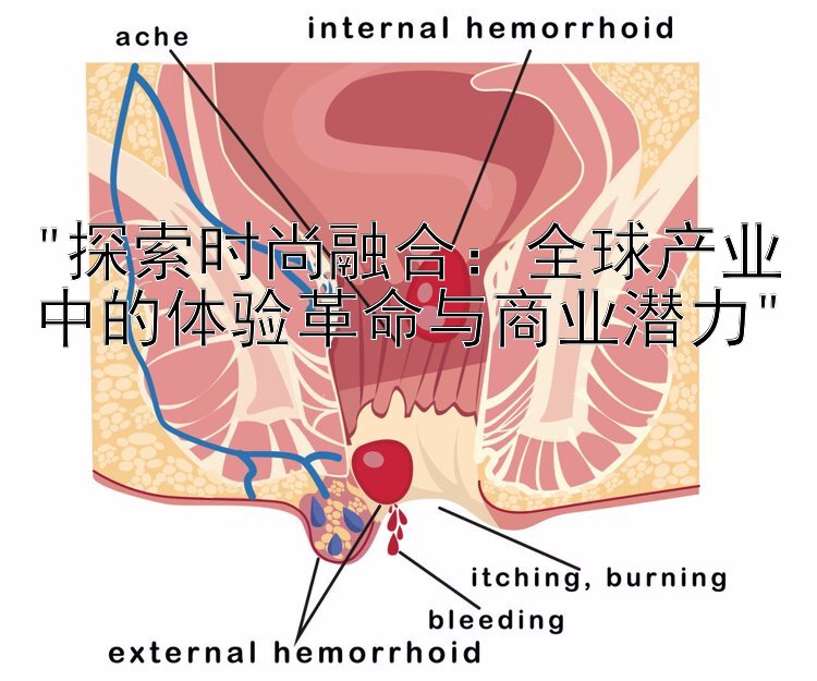 探索时尚融合：全球产业中的体验革命与商业潜力