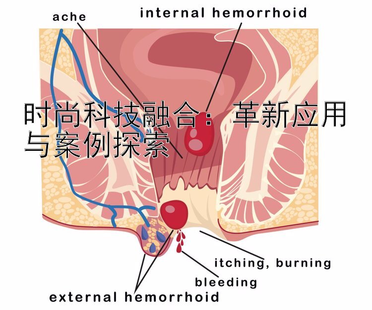 时尚科技融合：革新应用与案例探索