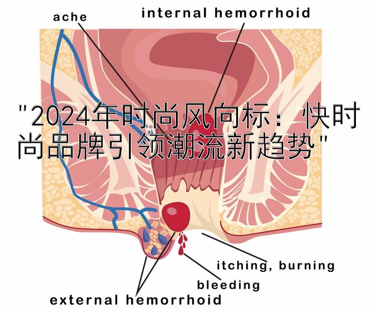 2024年时尚风向标：快时尚品牌引领潮流新趋势