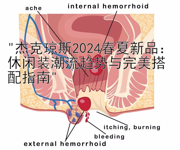 杰克琼斯2024春夏新品：休闲装潮流趋势与完美搭配指南