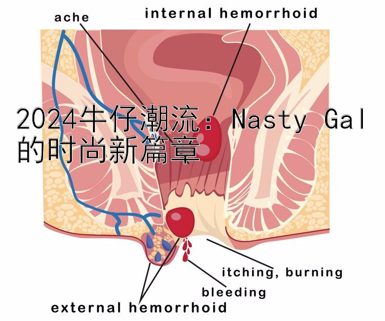 2024牛仔潮流：Nasty Gal的时尚新篇章